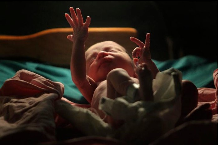 Những cử chỉ của một em bé vài phút sau khi chào đời tại bệnh viện Escuela ở thủ đô Tegucigalpa của Honduras. Tác giả: Edgard Garrido.